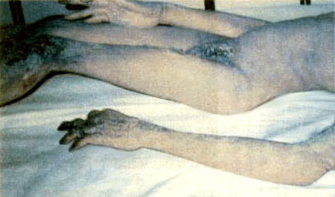File:I4lgrd.jpg