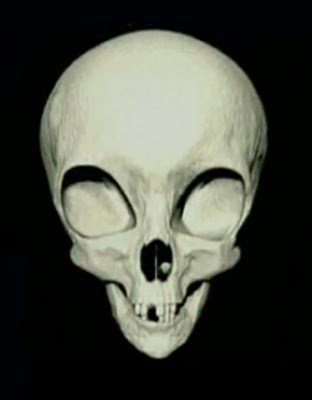 File:2009827111441cranio-1-.jpg