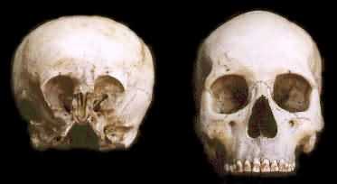File:Skull sc2.jpg