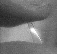 File:IMPLANT.jpg
