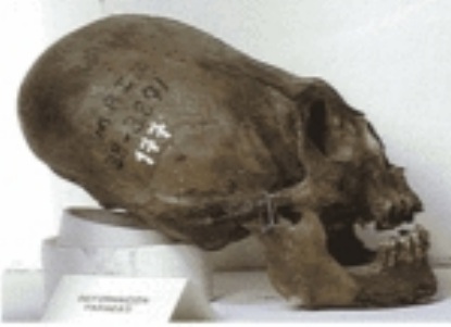 File:Testa2.jpg